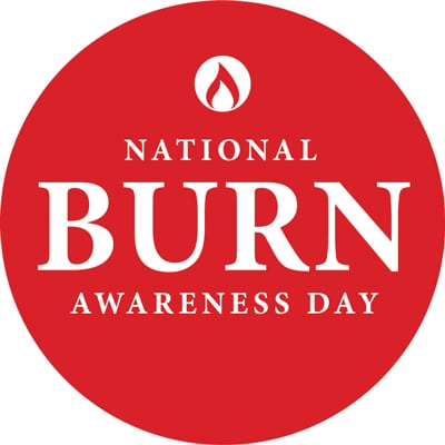 National Burns Awareness Day – Wednesday October 13th 2021