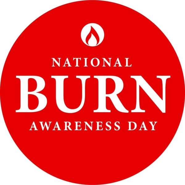 Burn Awareness Day UK October 12th 2022
